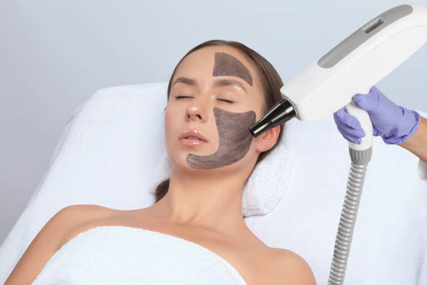 Is Laser Carbon Peel Safe for Sensitive Skin