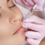 Is lip filler Effective for Aging or Dry Lips