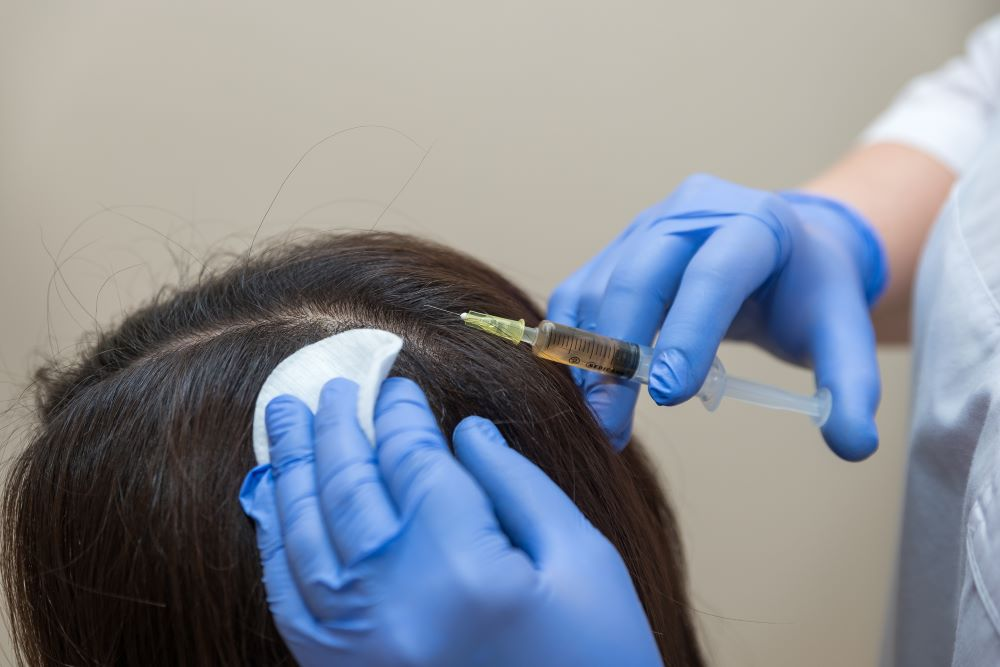 PRP-Vs-PRF-For-Hair-Loss-Which-O