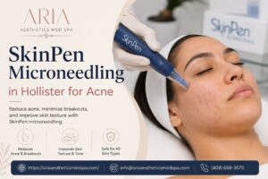 SkinPen Microneedling in Hollister 1