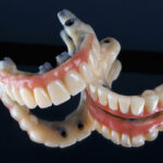 Smile nambour_all-on-4-dental-implants