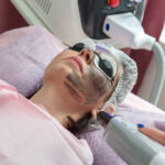What Laser Carbon Peel Benefits Help Achieve Youthful Skin