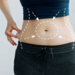 What Liposuction Procedures Target Multiple Body Areas