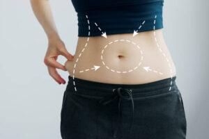 What Liposuction Procedures Target Multiple Body Areas