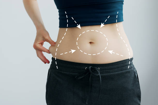 What Liposuction Procedures Target Multiple Body Areas