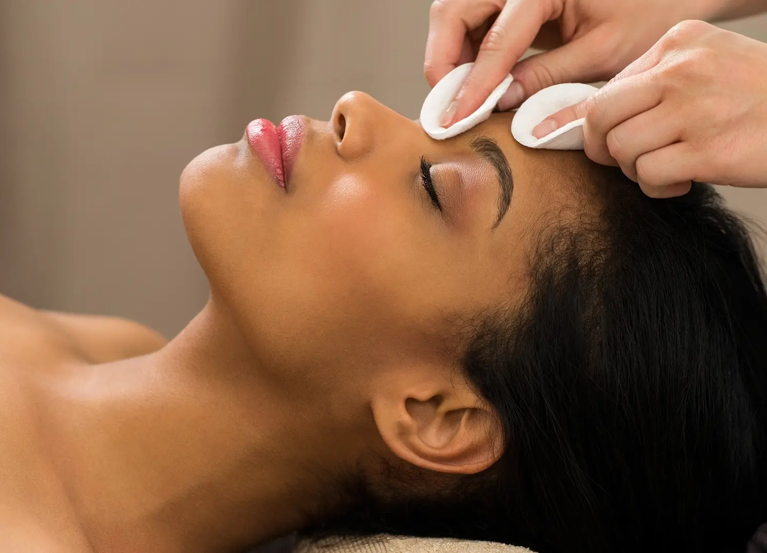 Chemical Peels Treatment
