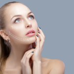 facelift
