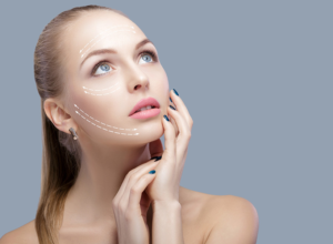 facelift