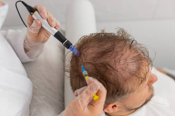 How Exosome Technology in Hair Restoration Works: The Science Explained Simply