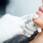 Are Lip Fillers Injection Results Immediate and Noticeable