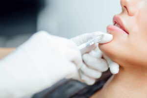 Are Lip Fillers Injection Results Immediate and Noticeable