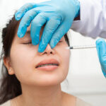 Can Botox for Nose Improve Nose Symmetry