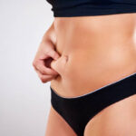 Can Mini Abdominoplasty Help Remove the Stubborn Mummy Tummy