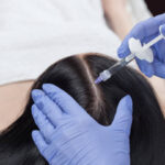 Can PRP Treatment Improve Hair Texture and Growth