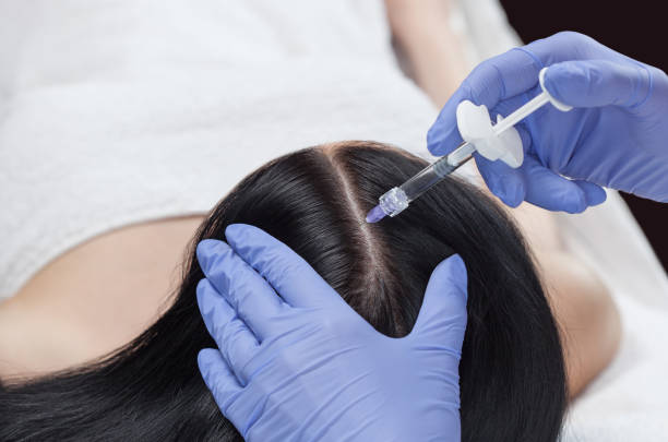 Can PRP Treatment Improve Hair Texture and Growth