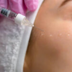 Do Dermal Fillers Help Smooth Deep Facial Wrinkles