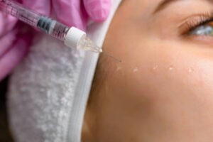 Do Dermal Fillers Help Smooth Deep Facial Wrinkles