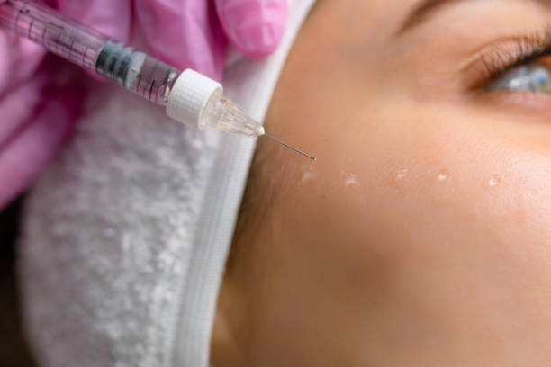 Do Dermal Fillers Help Smooth Deep Facial Wrinkles