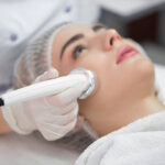 Does CO2 Laser Improve Overall Skin Appearance
