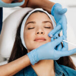 Does PRP Treatment Work for Acne Scars
