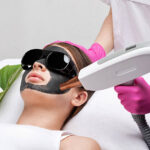How Does Laser Carbon Peel Improve Skin Tone