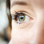 Is Eye Bag Removal Worth It for Lasting Results