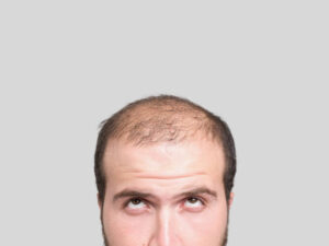 Is GFC Treatment for Hair Safe for All Hair Types