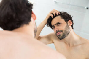 Is Hair Transplant the Best Hair Restoration Option