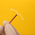 Is IUD for Contraception a Reversible Birth Control