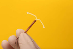 Is IUD for Contraception a Reversible Birth Control