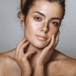 Is Melasma Treatment a Permanent Solution for Pigmentation
