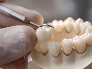 dental care in Simi Valley