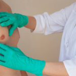 What Results Can You Realistically Expect from Gynecomastia Surgery
