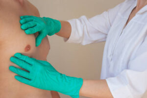 What Results Can You Realistically Expect from Gynecomastia Surgery