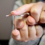When Should You Start Contraception Treatment