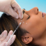 botox-dubai1 (1)