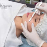 dermaplaning tucson