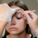 Eyebrow Lift