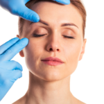 Eyelid Xanthelasma Removal