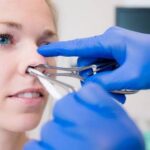 How to Choose the Best Clinic for Deviated Septum Surgery in Dubai