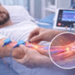 Peripheral Nerve Repair