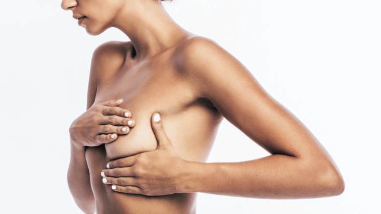 Breast Augmentation