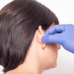 Who Should Choose Otoplasty Surgery in Dubai