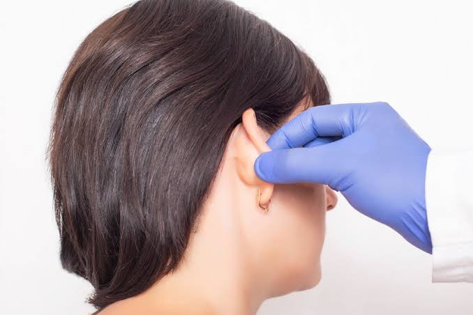 Who Should Choose Otoplasty Surgery in Dubai