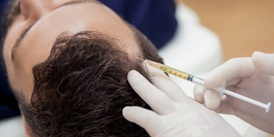 DHI Direct Hair Implant in Dubai