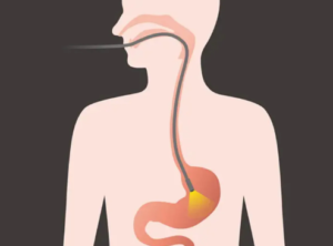 gastroscopy clinic Singapore