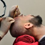 hair transplant in pune