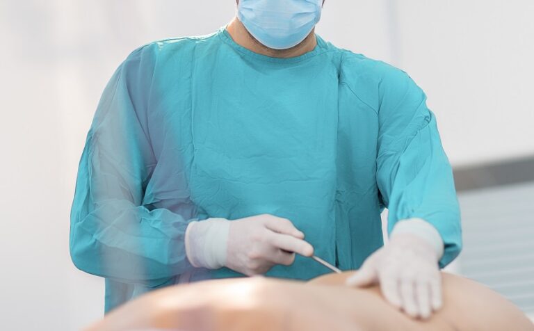 Liposuction