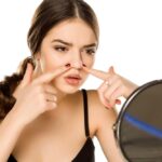 Rhinoplasty