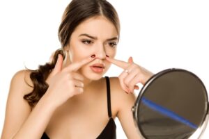 Rhinoplasty